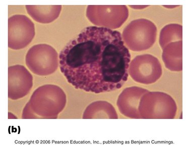 Eosinophil under microscope