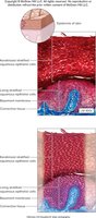 Keratinized stratified squamous epithelium