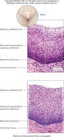 Nonkeratinized stratified squamous epithelium