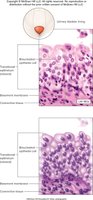 Transitional epithelium