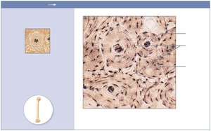 Bone tissue structure