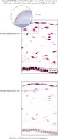 Simple squamous epithelium