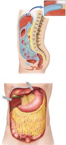 Sagittal and anterior views of the peritoneal folds and omenta