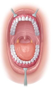 Anatomy of the oral cavity showing teeth, tongue, and palate