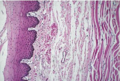 Histological section of the GI tract wall showing mucosa, submucosa, and muscularis