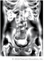 X-ray of urinary system location