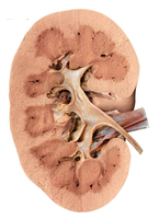 Sectioned kidney showing cortex and medulla