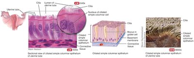 Ciliated simple columnar epithelium