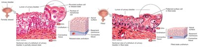 Transitional epithelium