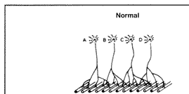 Normal motor neuron innervation