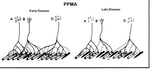 PPMA early and late disease