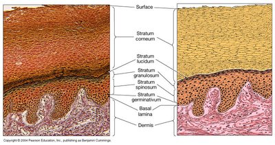 Histological section showing all layers of the epidermis and dermis