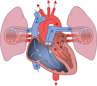 Right vs left ventricle wall thickness