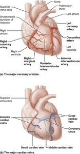 Coronary artery blockage and myocardial infarction