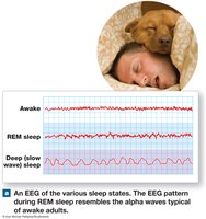 EEG of sleep states: awake, REM, and deep sleep