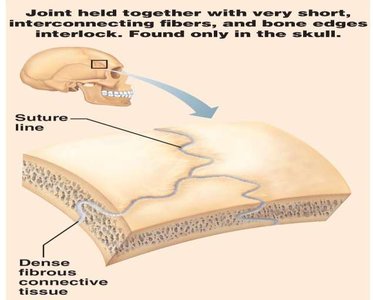 Suture joint in the skull