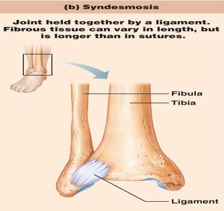Syndesmosis joint between tibia and fibula