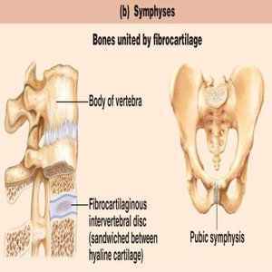 Symphysis joint: intervertebral disc and pubic symphysis