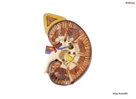 Kidney cross-section showing cortex, medulla, pelvis, and vessels