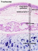 Histological section of trachea showing mucosa, submucosa, and cartilage