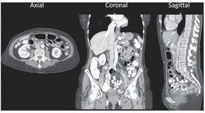 Medical imaging examples of axial, coronal, and sagittal planes