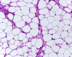Microscopic image of adipose (fat) cells