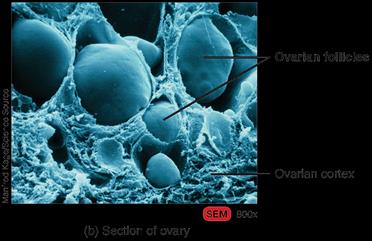 Section of ovary showing follicles and corpus luteum