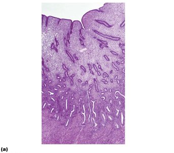 Histology of endometrium and its blood supply