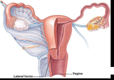 Frontal section of female reproductive tract showing vagina and adjacent structures