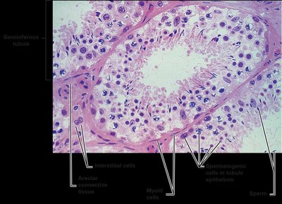 Histological section of seminiferous tubule showing spermatogenic and interstitial cells