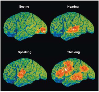 Functional areas of the cerebral cortex