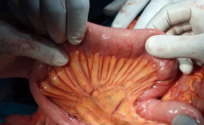Intraperitoneal and retroperitoneal organs diagram