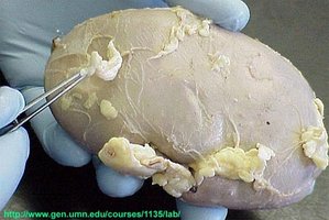 Kidney with coverings and fat capsule