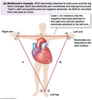 ECG vs. myocardial action potential