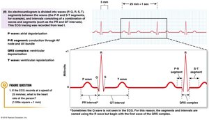 ECG deflection and current flow direction