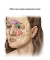 Paranasal sinuses in the skull