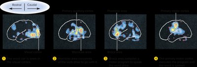 PET scans showing brain activity