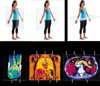 Body planes and corresponding MRI scans