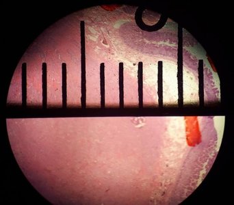 Field of view diameter measured in a microscope