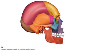 Sutures in the skull