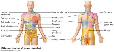 Common locations of referred visceral pain