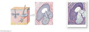 Diagram and histology of sebaceous gland