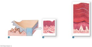 Cross-section of thin and thick skin showing epidermal layers