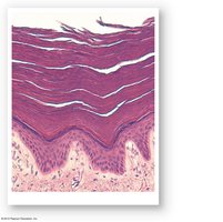 Histological section showing stratum corneum