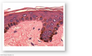 Histological section showing melanocytes and melanin pigment