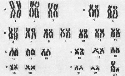 Human male karyotype (black and white)