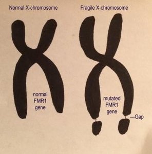 Normal vs. fragile X chromosome