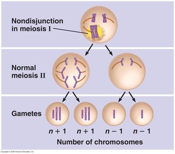 Nondisjunction in meiosis I