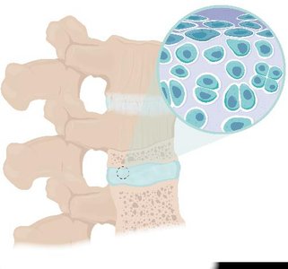 Structural classes of joints