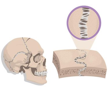 Interosseous membrane between radius and ulna